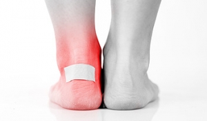 Blisters Will Gradually Drain