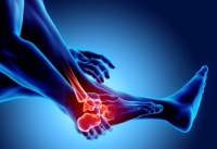Types of Foot Arthritis